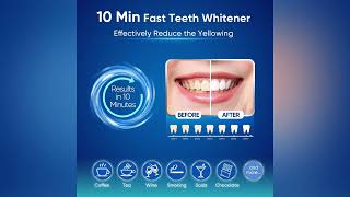 MySmile Teeth Whitening Kit for Sensitive Teeth with LED Light [upl. by Nalliuq]