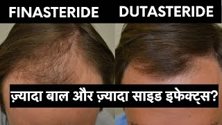 Finasteride vs Dutasteride in hindi  ये बातें कोई नहीं बताएगा [upl. by Tirrej]