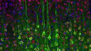 Lecture 5 Optical Imaging of Brains [upl. by Bachman]