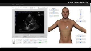 RIGHT VENTRICULAR OUTFLOW TRACT RVOT FLOW SPECTRAL PW CW DOPPLER [upl. by Gregorius]