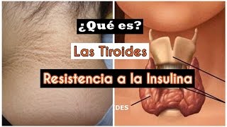 Tiroides y Resistencia a la insulina  Mente de Mujer por Carolina HD [upl. by Kantor]