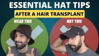 7 Essential Hat Tips AFTER a Hair Transplant [upl. by Hgiel]