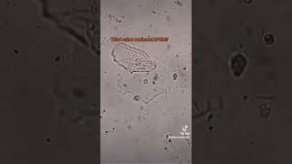 what urine sediment is this urine urinalysis microscope laboratory bacteria urinesediment [upl. by Civ]