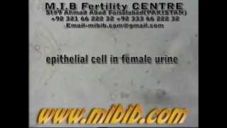 epithelial cells in female urine [upl. by Adehsar945]