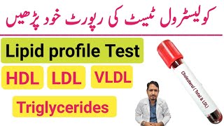 How To Read Cholesterol Test Report Urdu Hindi  Lipid Profile Test  HDL LDL amp Triglycerides Test [upl. by Myrt]