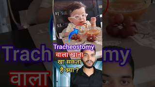 Tracheostomy patient feeding shorts [upl. by Aik401]