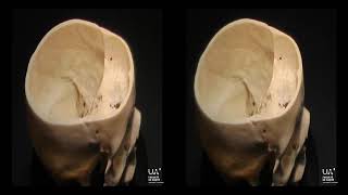 Anatomie 3D de létage moyen de la base du crâne [upl. by Alysia]