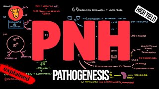 Paroxysmal Nocturnal Hemoglobinuria Pathogenesis Symptoms Diagnosis Treatment [upl. by Darach]