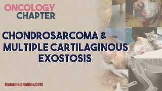 chondrosarcoma amp MCE lecture 3 [upl. by Jemy234]