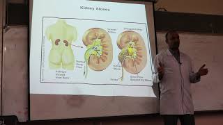 Gout and Hyperuricemia By Dr Dheyaa Jabbar [upl. by Strephonn]