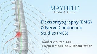 Electromyography EMG amp Nerve conduction studies NCS [upl. by Iinden257]