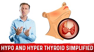 Hyperthyroid vs Hypothyroid Explained By Dr Berg [upl. by Wilburn884]