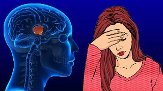 Pituitary Gland Disorders Symptoms And Treatment [upl. by Domenico]