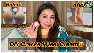 Get Rid Of Cracked Heels This Winter😍 DIY Cracked Heel Cream With Simple Ingredients 👍Magical Result [upl. by Einwat]