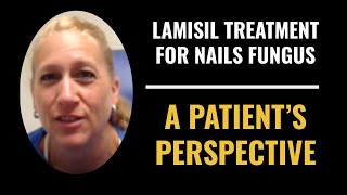 Lamasil Treatment For Treating Nail Fungus onychomycosis [upl. by Greggory]