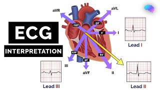 How to Read an ECG  ECG Interpretation  EKG  OSCE Guide  UKMLA  CPSA [upl. by Eydnarb]