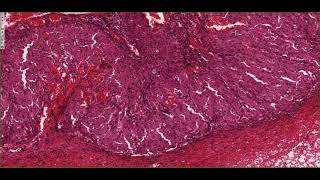 Histology of the Corpus Luteum 4K [upl. by Amsa]