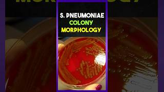 Streptococcus Pneumoniae Colony morphology [upl. by Epner]