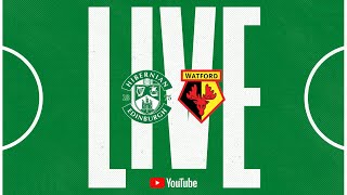 LIVE Hibernian vs Watford  PreSeason Fixture [upl. by Siladnerb]