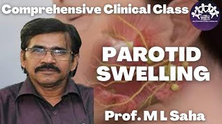 Parotid Swelling  Clinical Case Presentation [upl. by Saville]