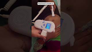 Fetal heart sounds using Doppler⭐️ [upl. by Grannie166]