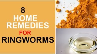 8 Home Remedies For Ringworms [upl. by Barclay]