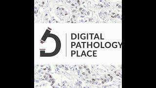 97 DigiPath Digest 5 AI in Modern Medicine Diagnostics and Healthcare Outcomes [upl. by Fesoj]