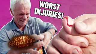 The WORST Injuries Part 1  COMPILATION  River Monsters [upl. by Canotas]