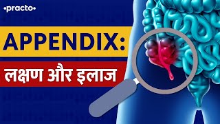 Appendix What Are Symptoms of Appendicitis  Appendicitis Treatment In Hindi  Practo [upl. by Hoskinson]