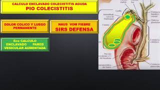 COLECISTITIS AGUDA [upl. by Chloras]