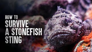 How to Survive a Stonefish Sting [upl. by Reyotal353]