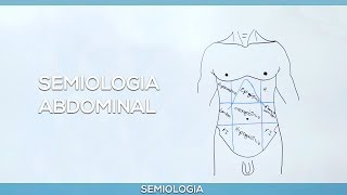 Semiologia Abdominal [upl. by Larianna]