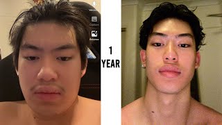 1 YEAR GLOWUP MOTIVATION  KINGHENRY [upl. by Ninette]