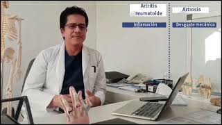 8 Síndromes Articulares Inflamatorio Artritis Reumatoidea [upl. by Akeinahs]