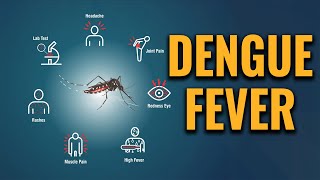 Dengue fever  Symptoms and causes [upl. by Haela]