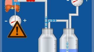 2KammerSystem mit Sog – Funktionsweise  Thoraxdrainage für Einsteiger [upl. by Eilraep]