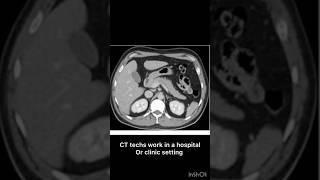 What does a CT Tech do diagnosticradiology breastcancerscreening anatomy radtech [upl. by Furlani]