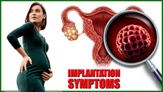 Implantation Symptoms – Top 7 Early Signs and Symptoms of Implantation [upl. by Joey325]