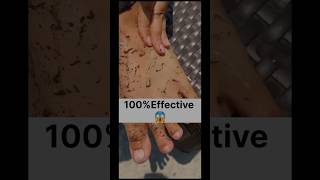 Permanent Feet Dirt amp Tanning Removal pack Most Easy pedicureTry This Packskincareytshortsviral [upl. by Rutan518]