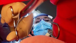 ASMR Surgery  POV Youre a Surgical Instrument Accidentally Left Inside a Patient [upl. by Darrel]