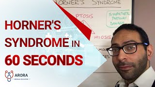 Horners Syndrome in 60 seconds [upl. by Adimra]