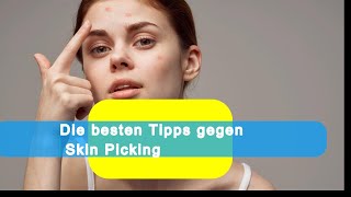 Die besten Tipps gegen Skin Picking [upl. by Silyhp]