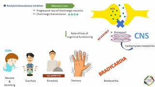 ALZHEIMERS DISEASE amp ITS TREATMENT [upl. by Hagi828]