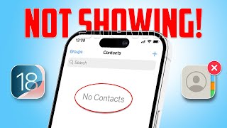 How to Fix Contacts Disappeared on iPhone  Contacts Gone After iOS 18 Update [upl. by Bascio]