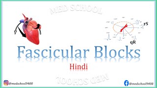 Fascicular Blocks Hindi [upl. by Arotahs183]