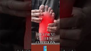 How to Treat Common Foot Conditions Hammer Claw amp Mallet Toe The Power of Physiotherapy [upl. by Lemhaj]