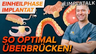 Provisorium nach Implantation  So überstehst du die Einheilphase optimal [upl. by Niltak893]