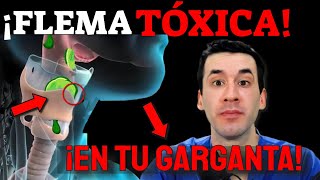 FLEMA TÓXICA en TU GARGANTA ¡ELIMÍNALA INMEDIATAMENTE [upl. by Dranal]