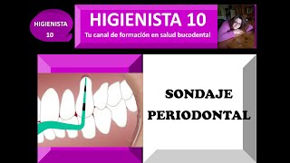 SONDAJE PERIODONTAL TEMARIO GENERAL 25 [upl. by Anivad858]