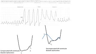 Hemodynamics 1 Essential hemodynamics pitfalls anomalies Elias Hanna Univ Iowa [upl. by Eli]